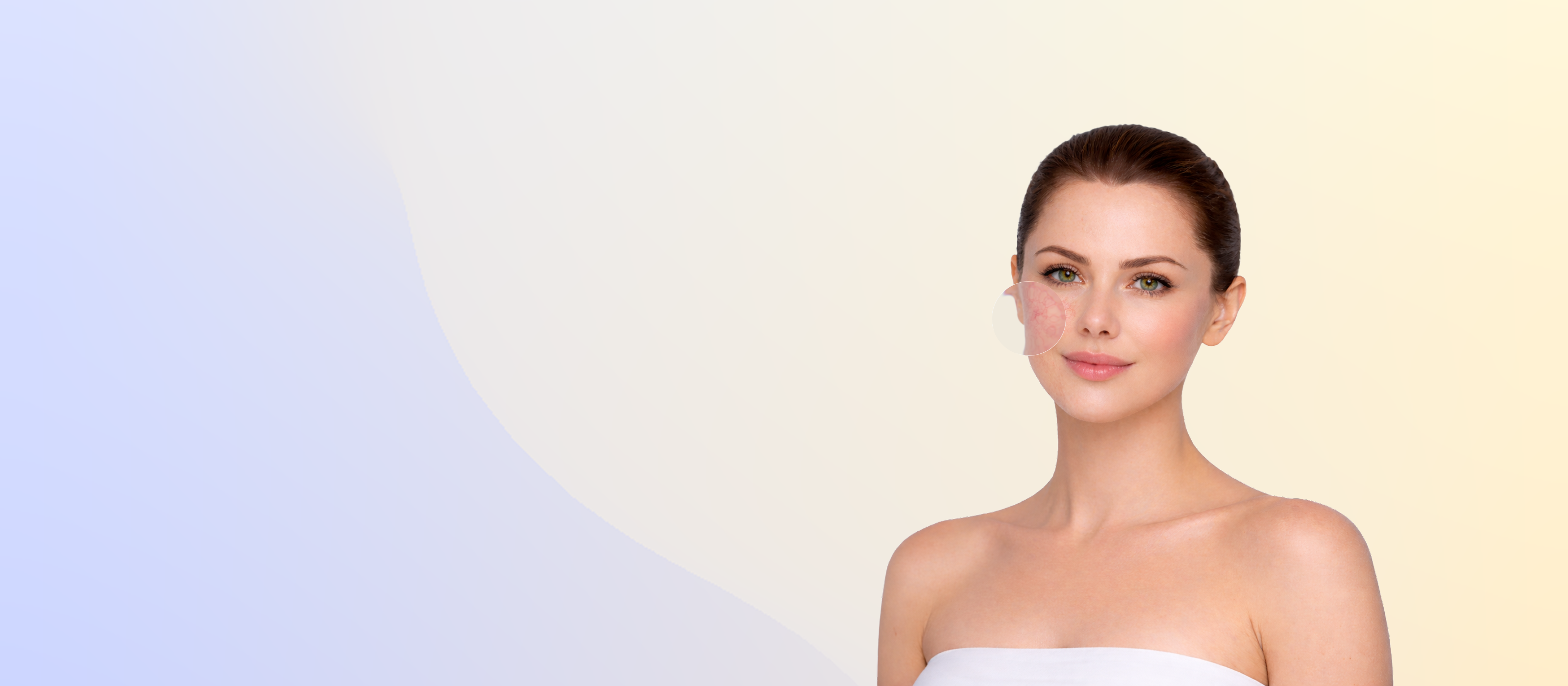 Удаление сосудов на лице и теле