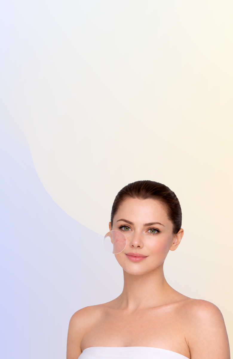 Удаление сосудов на лице и теле