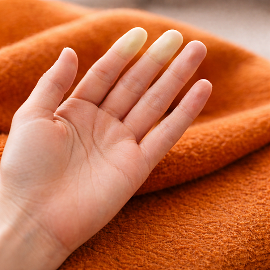 Пальцы белеют и синеют на холоде или от стресса? Это может быть серьезно! 